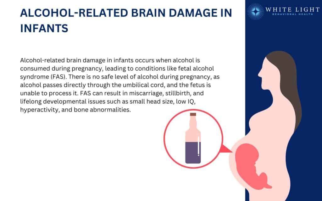 Alcohol-Related Brain Damage in Infants