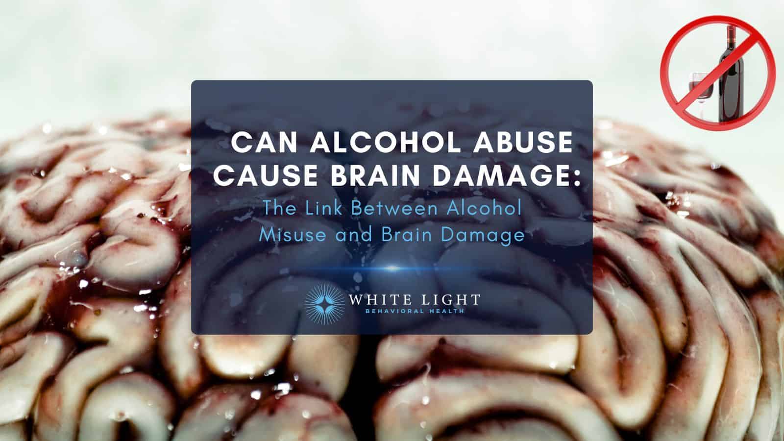 A brain with damage from alcohol